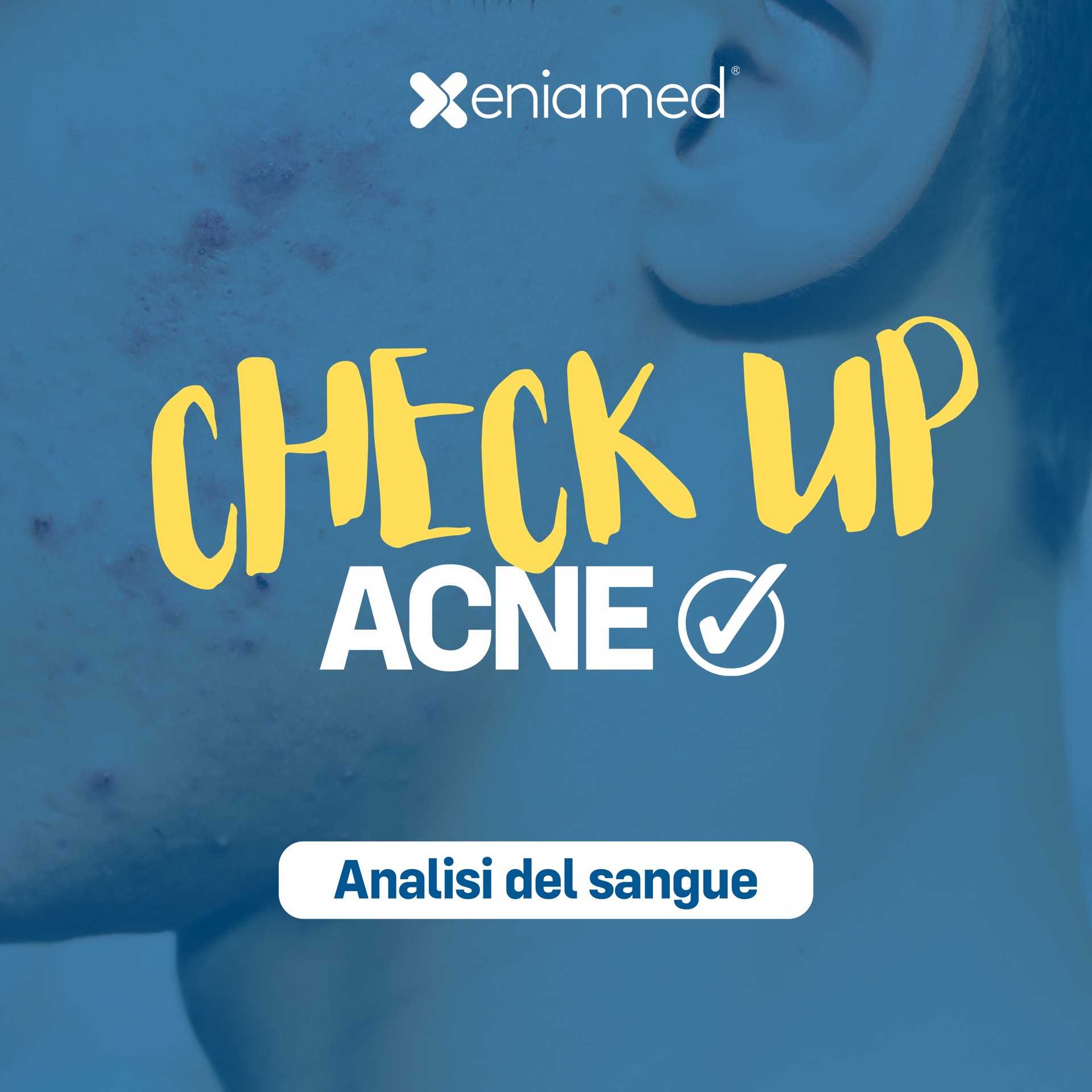 CheckUp Acne